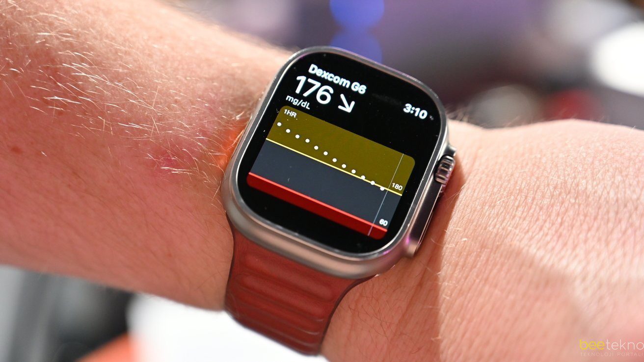 Dexcom G7 ile Şeker Takibi Artık Apple Watch’ta!